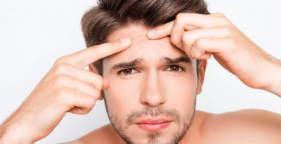 درمان جای جوش صورت