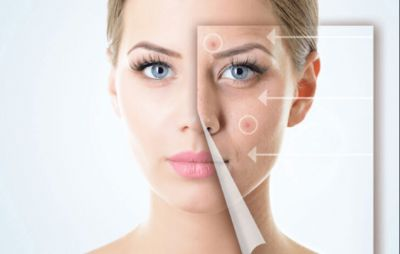 ماسک های ضد جوش